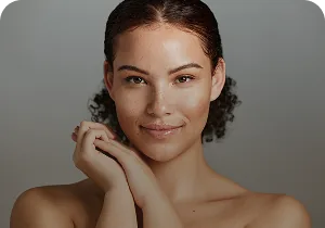 Smiling woman with her hands near her chin – BioRePeelCl3 biostimulating peel