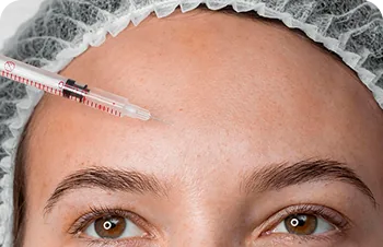 Forehead and frown lines – injection in the forehead