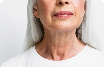 Lower face and neck – mature woman with grey hair