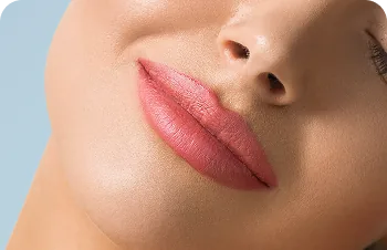 Natural lip contour with hyaluronic filler