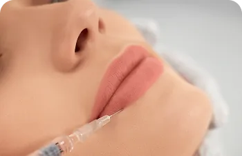 Lip fillers – injection into the lips