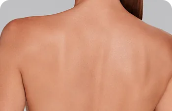 Back, where suitable – a woman's bare back and shoulders