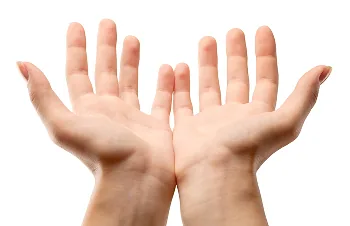 Palmar hyperhidrosis – open palms