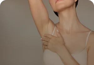 Woman raising her arm to show the underarm – hyperhidrosis