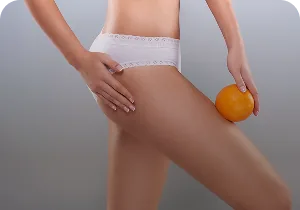 Woman holding an orange next to her thigh – injectable cellulite treatment