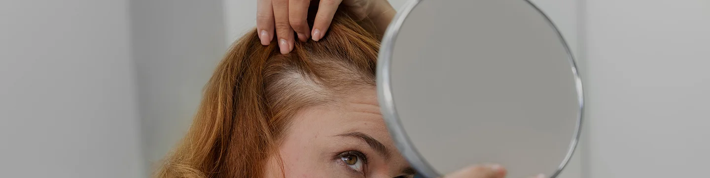 Hair loss