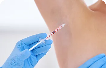 Hyperhidrosis treatment – injection in the underarm