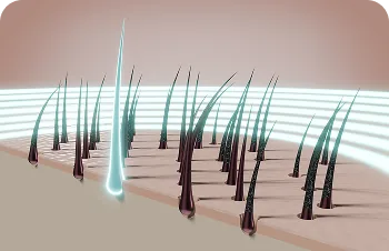 Plasma therapy for hair – illustration of hair follicles