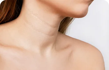 Polynucleotides for the neck and décolletage – a woman's neck and shoulder