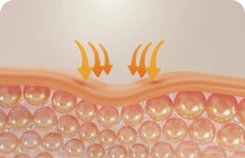 PRP facial (vampire facial) – illustration of the skin layers