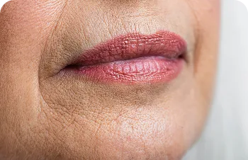 Restoring lips with age – lips of a mature woman